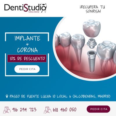 anuncio-implantes anuncio-implantes